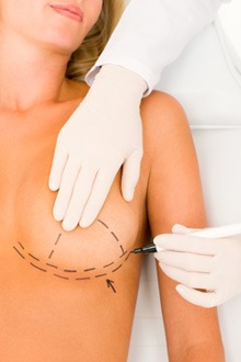 What are the facts about breast implants?